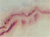 Logo Dermatology & Research Institute